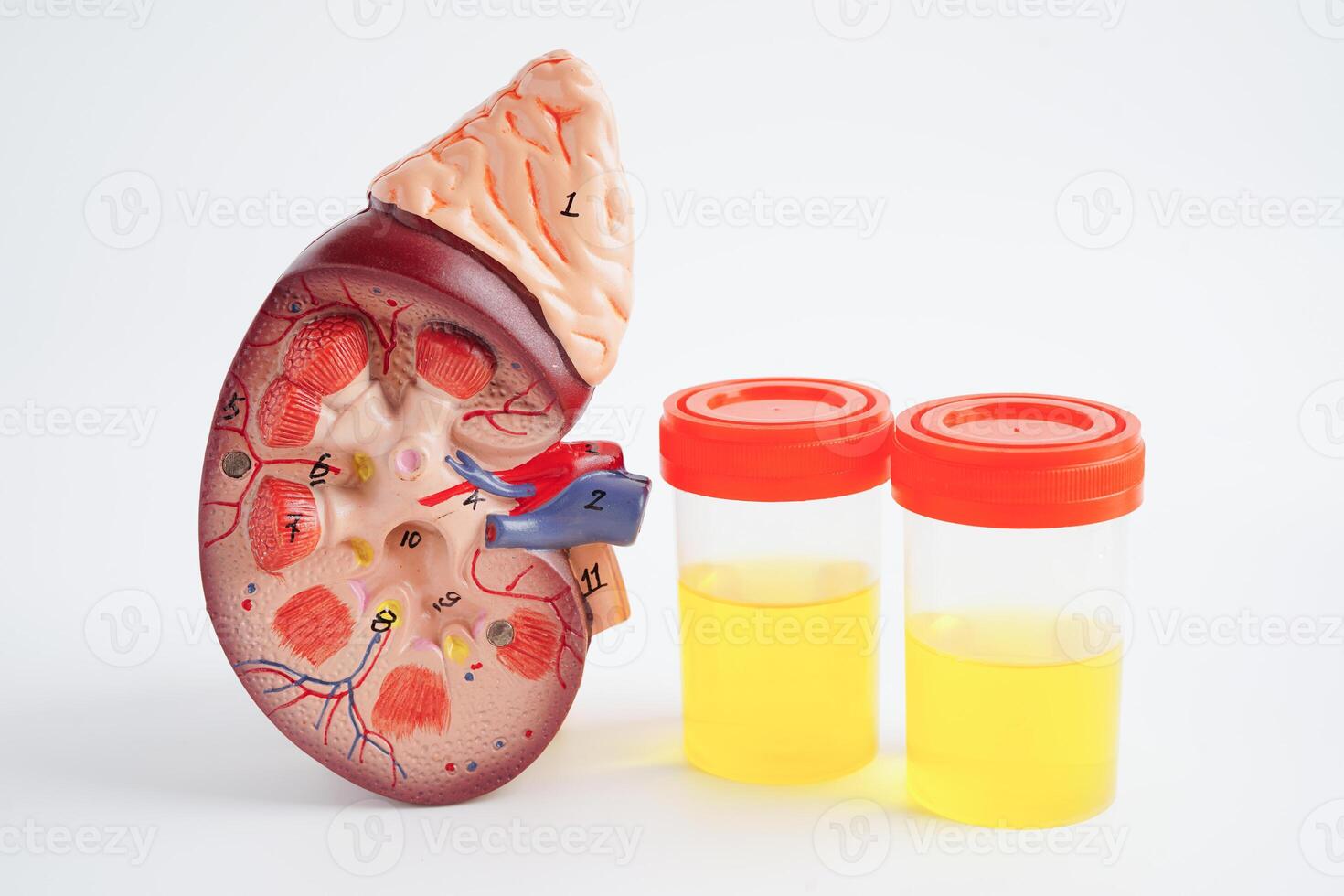 Urinalysis, Kidney and urine cup for check health examination in laboratory. photo