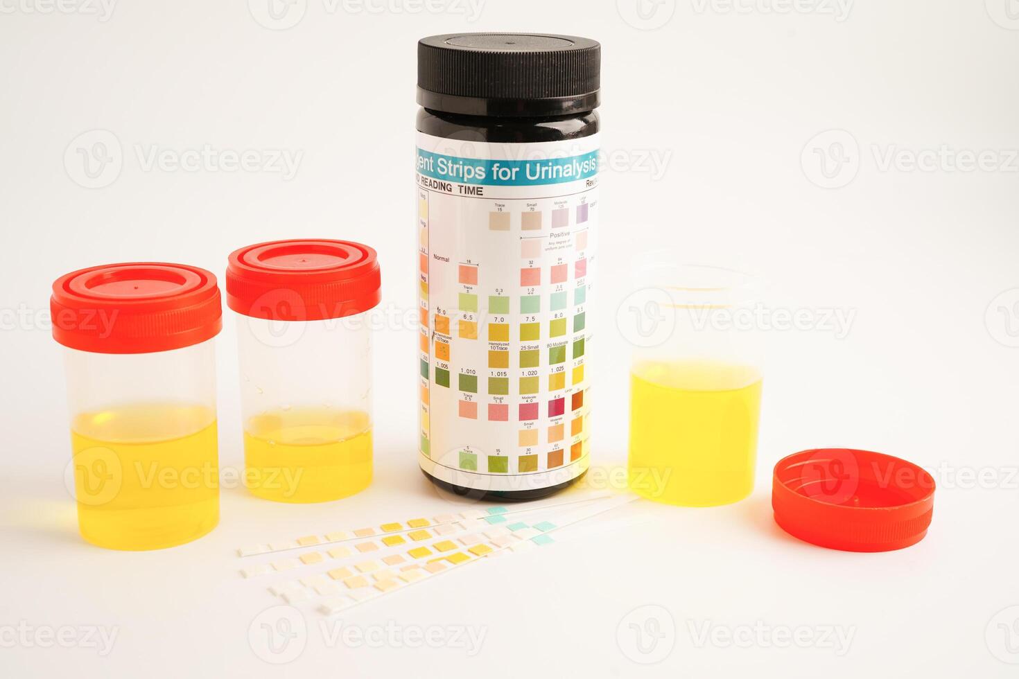 Urinalysis, urine cup with reagent strip pH paper test and comparison chart in laboratory. photo