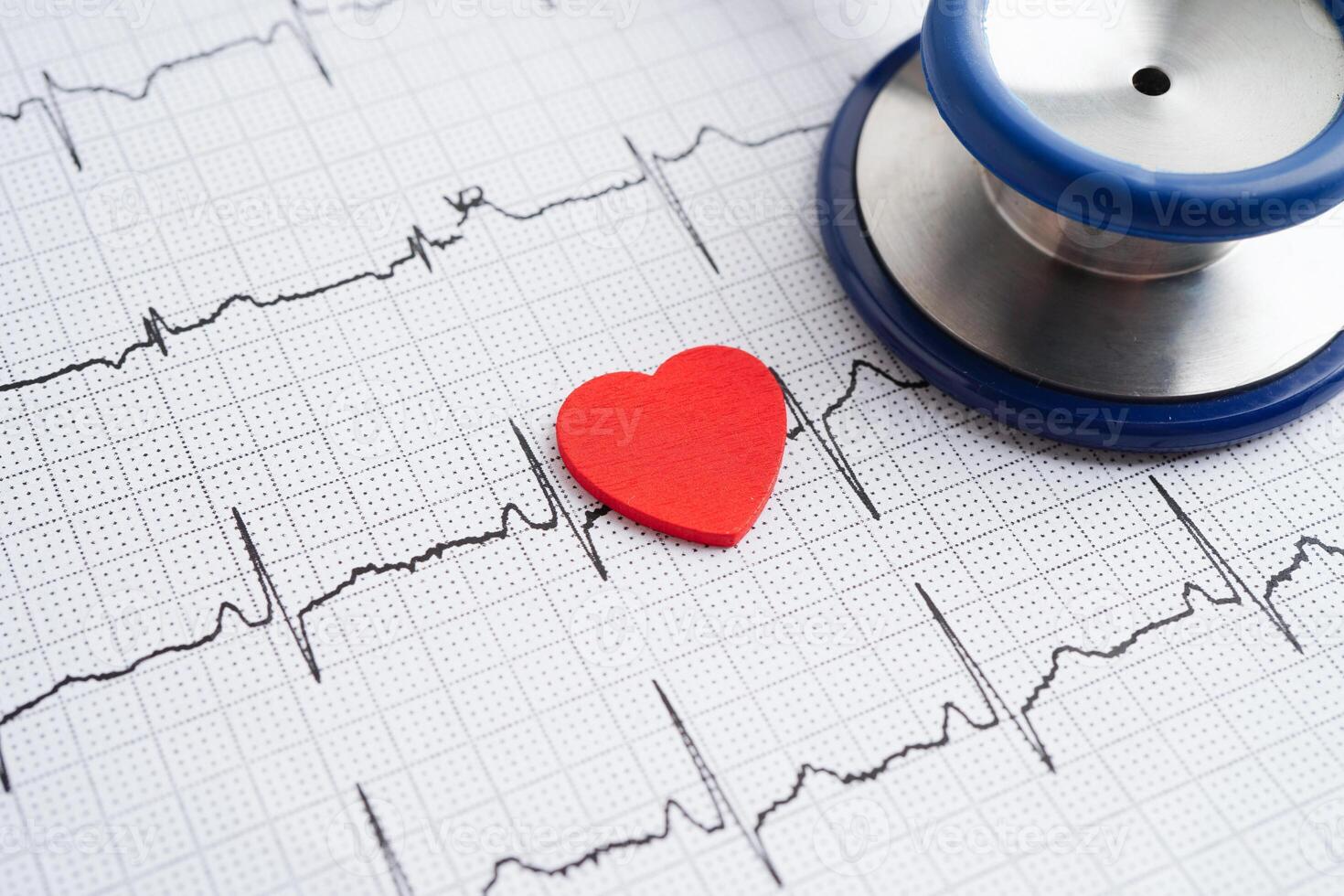 Stethoscope on electrocardiogram , heart wave, heart attack, photo