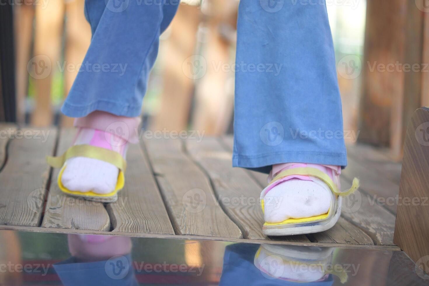 A little girl in orthosis shoes crosses a wooden bridge Child cerebral palsy disability. photo