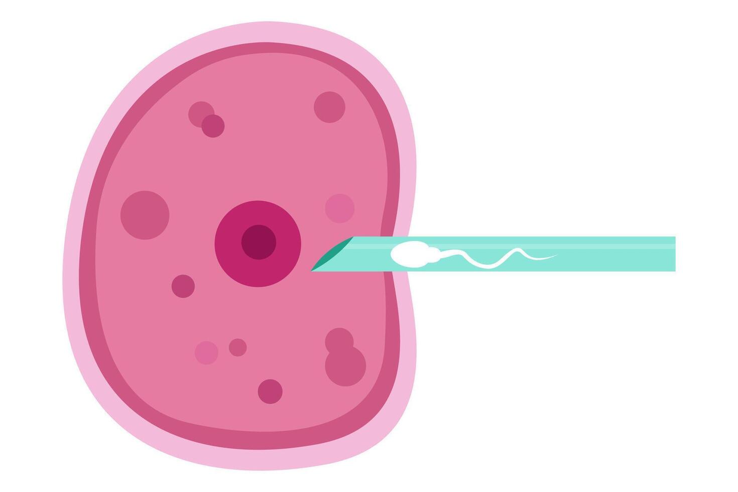 sperm and egg fertillization. In Vitro Fertillization , IVF vector