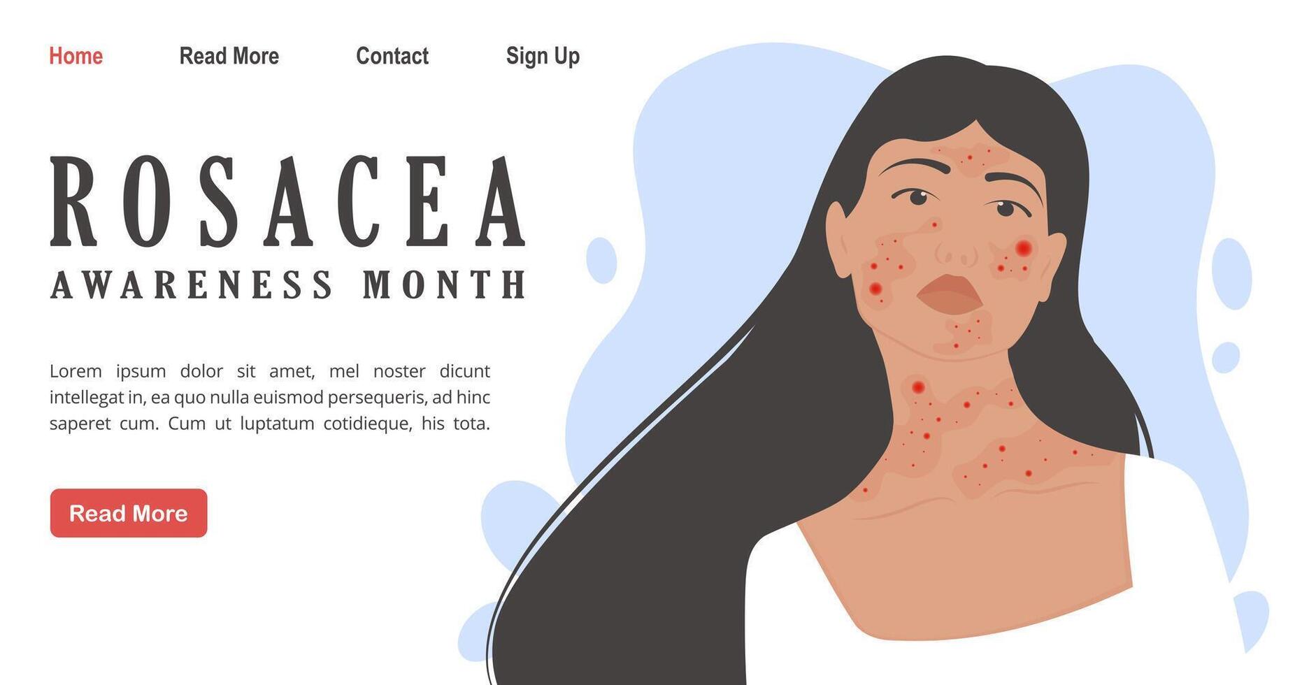 Woman with rosacea, psoriasis skin disease banner. April is Rosacea Awareness Month background template vector