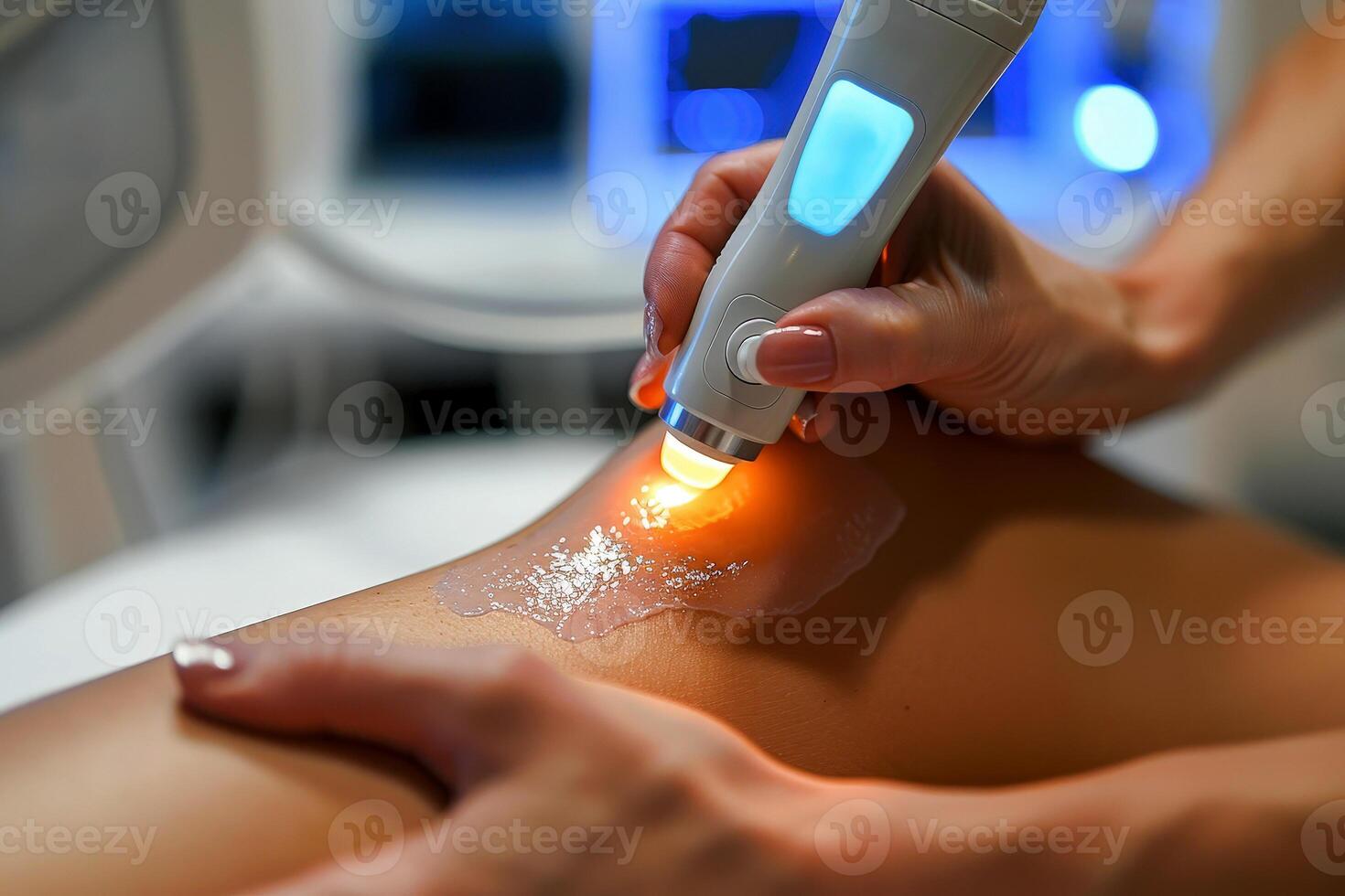 doctor use ultrasound radiofrequency device Chronic knee pain due to an inflamed knee joint prosthesis . photo