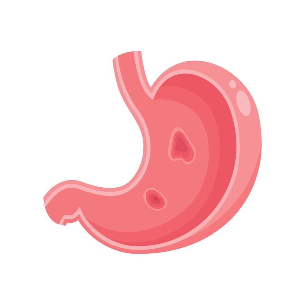 Isolated illustration graphic of a stomach with ulcers vector