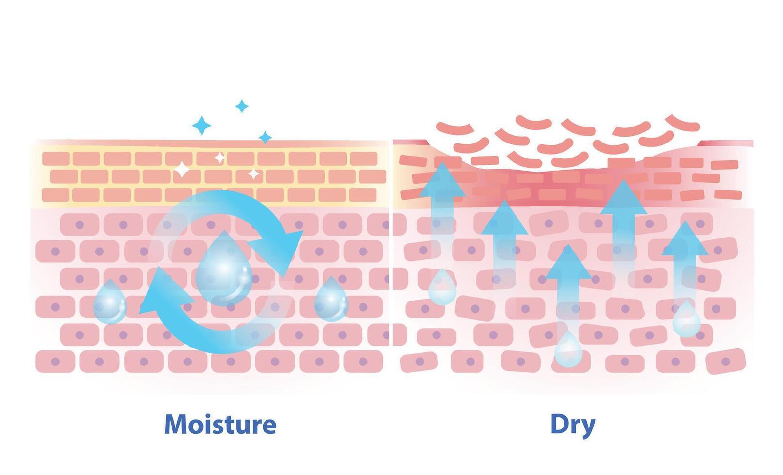 The mechanism of moisture and dry skin layer illustration. Comparison of skin hold oil, preserved in a good balance and dry skin lacking water, oil and peeling off in the uppermost layer. vector