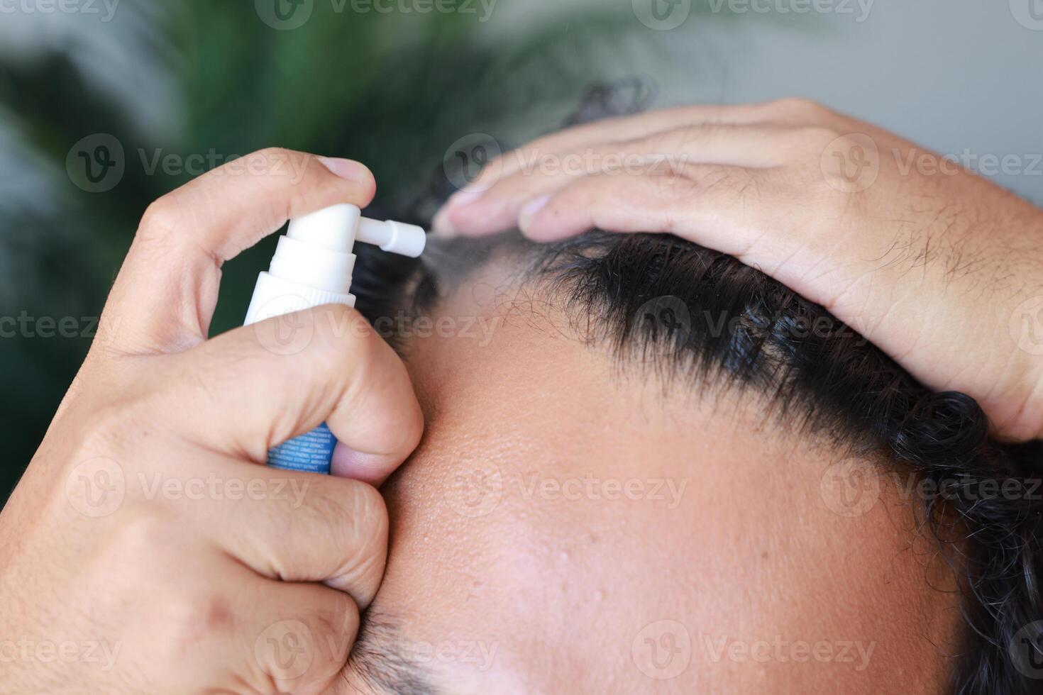 Asian men use serum spray to maintain strong hair and prevent breakage. Man with worry and touching on his head to show a bald head. Hair root nourishment. concept of healthcare, treat, medicine. photo