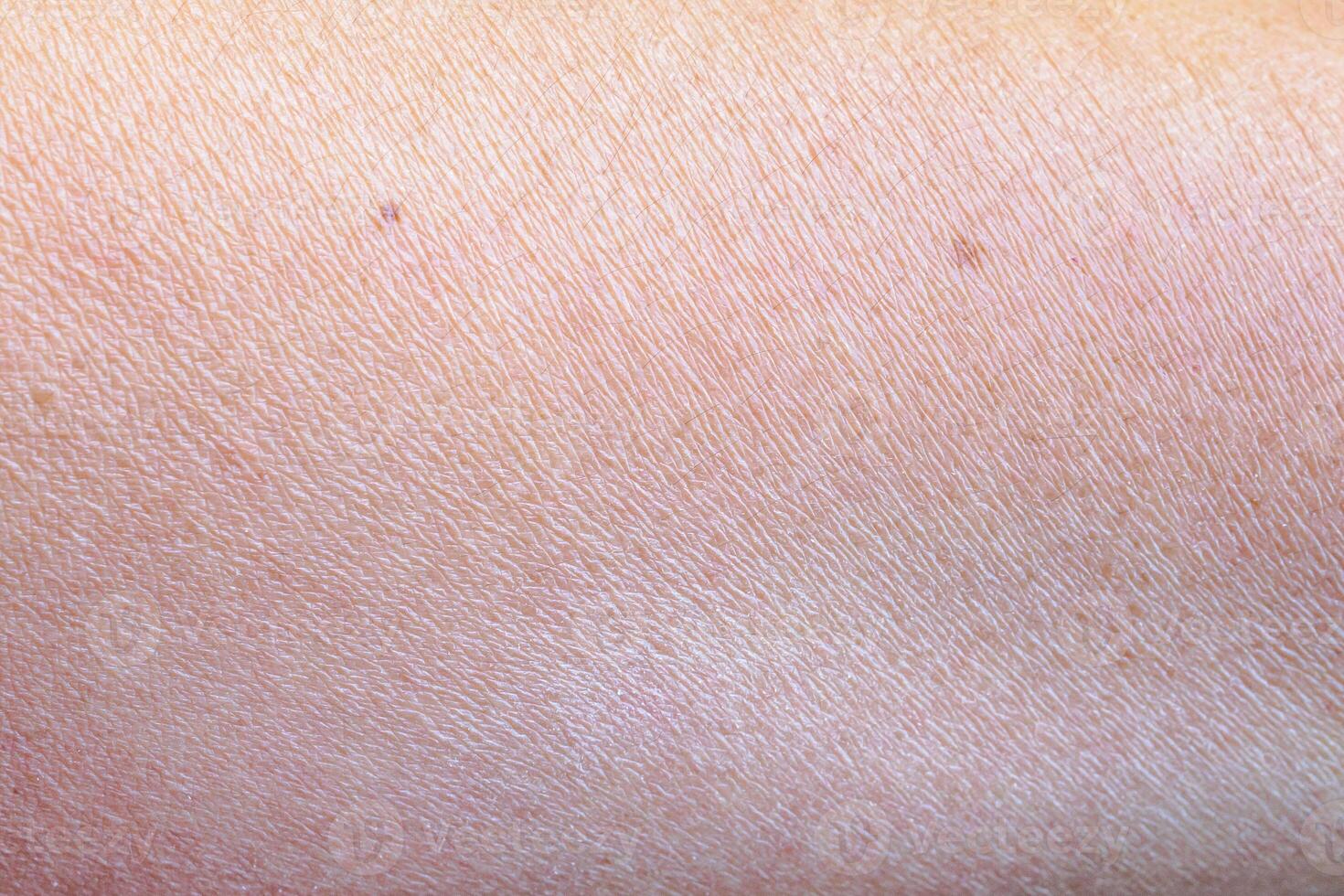 dry and dehydrated human skin texture background photo