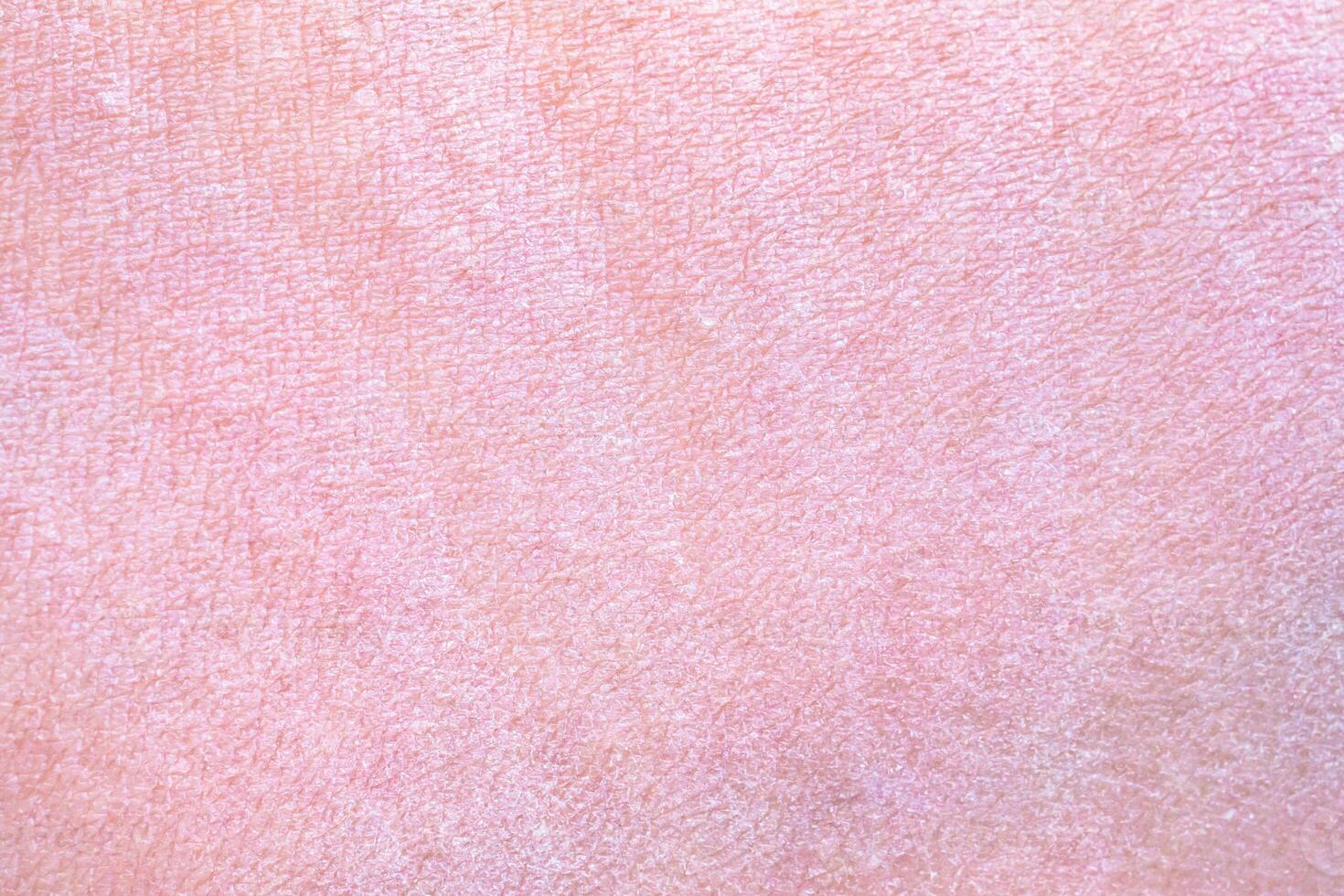 dry and dehydrated human skin texture background photo