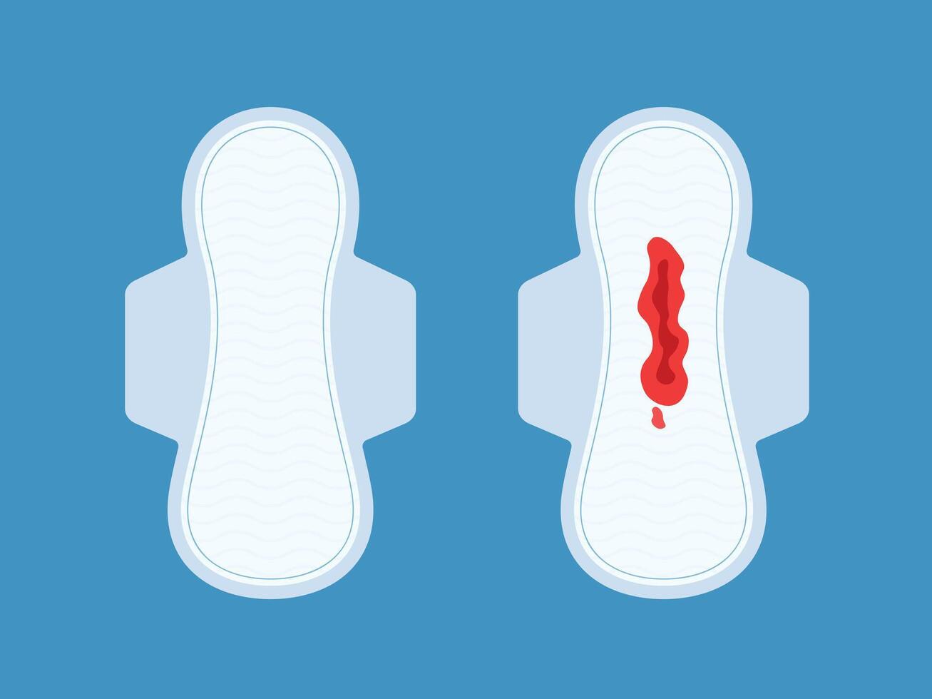 Menstrual blood period on the sanitary pad. Feminine hygiene vector