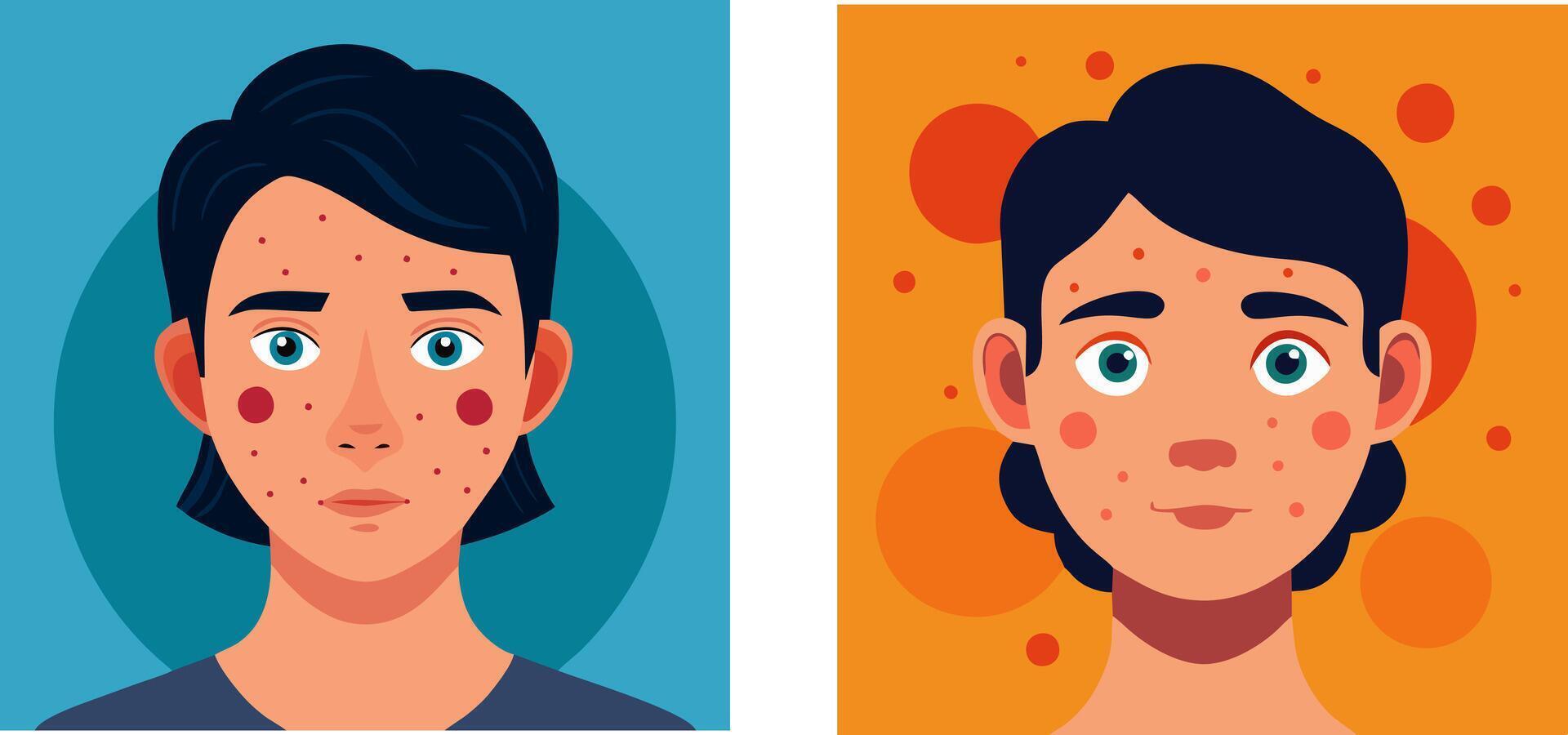 The face of a young man with acne vector