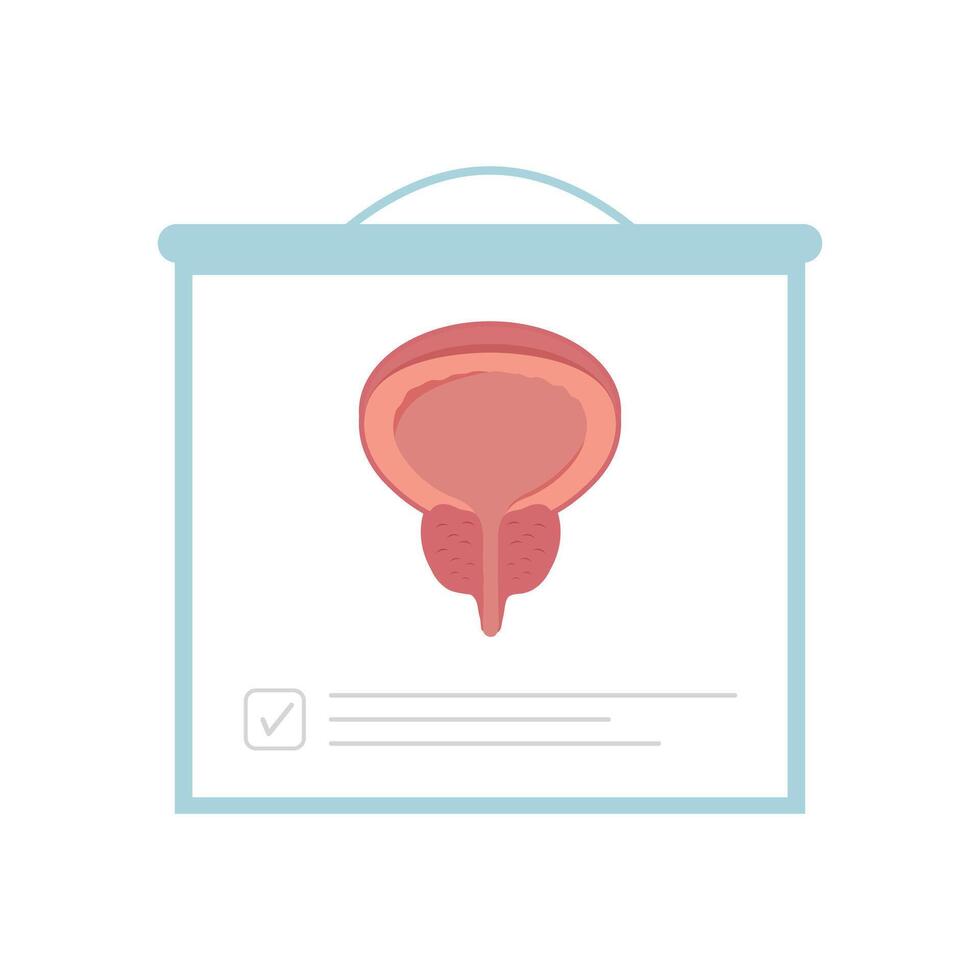 Human organ male prostate infographic, cartoon illustration icon for medical and healthcare and wellness vector