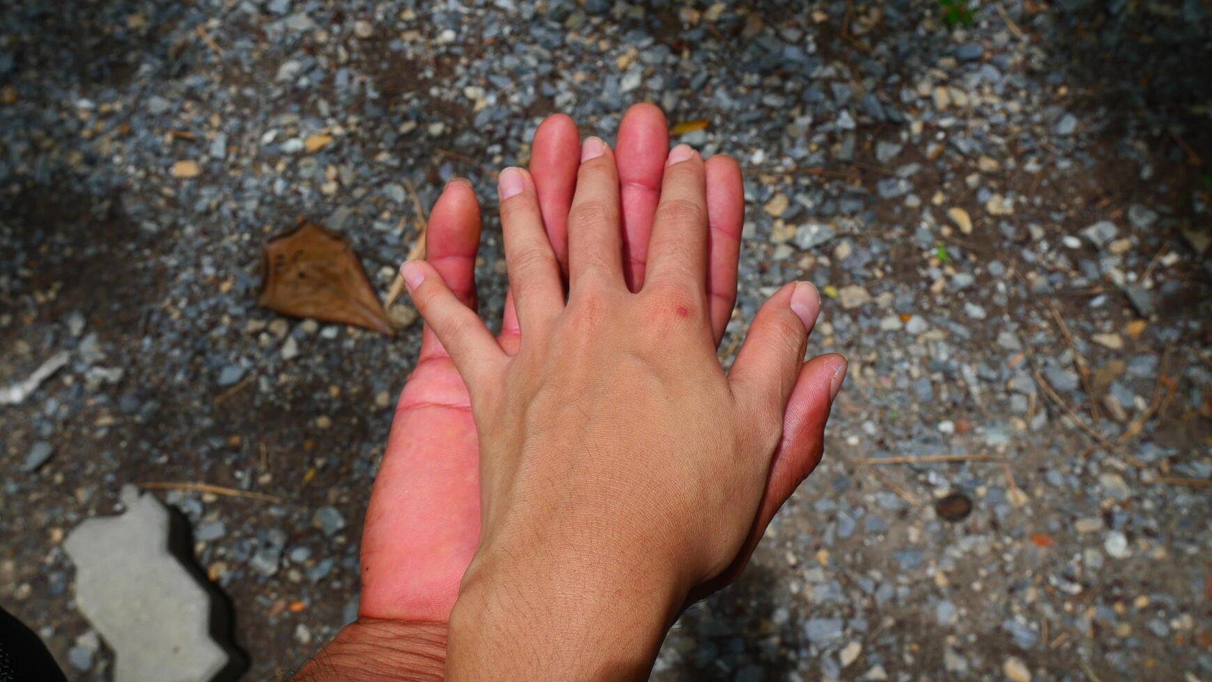 The hands of women and men of different skin colors and status were held together photo