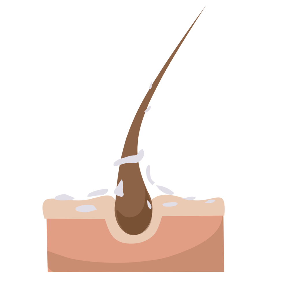 Dandruff hair Illustration png