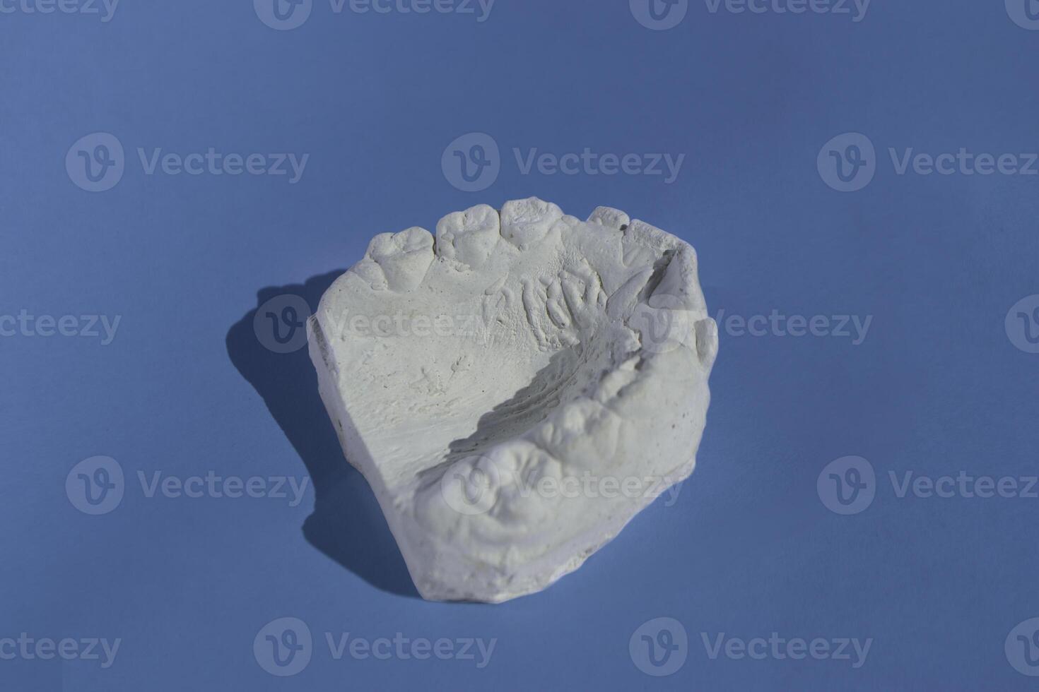 Dental casting gypsum model plaster cast stomatologic human jaws prothetic laboratory photo