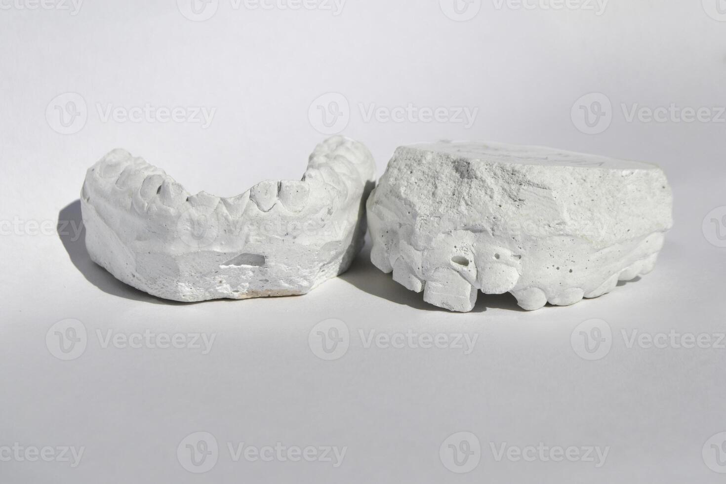 Dental gypsum model cast stomatologic human jaws photo