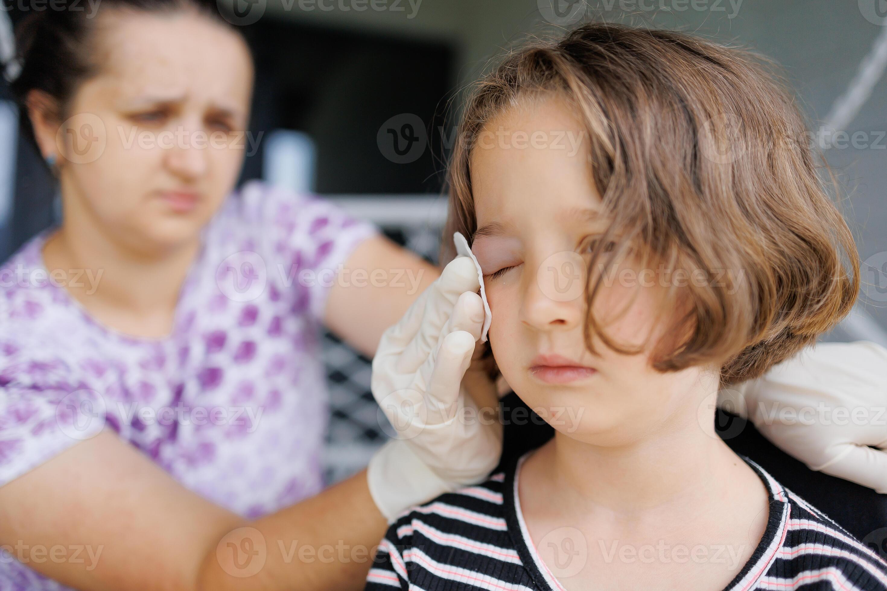 a small childhood infection on the eyelid caused by insect, mosquito or bee bites that causes