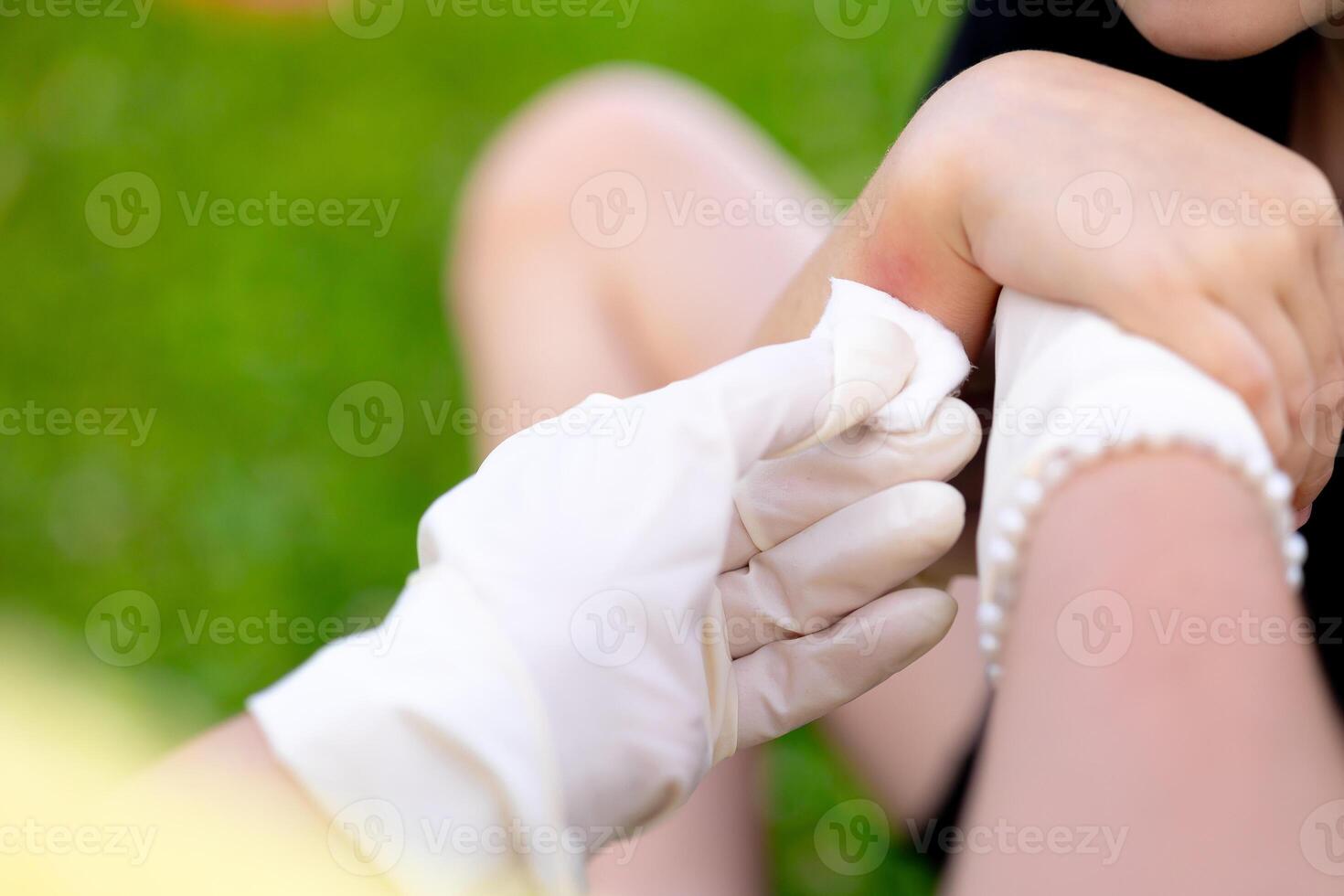 close-up photo of a mother applying cream to her child's hand after an insect, mosquito or bee bite in the summer in the yard