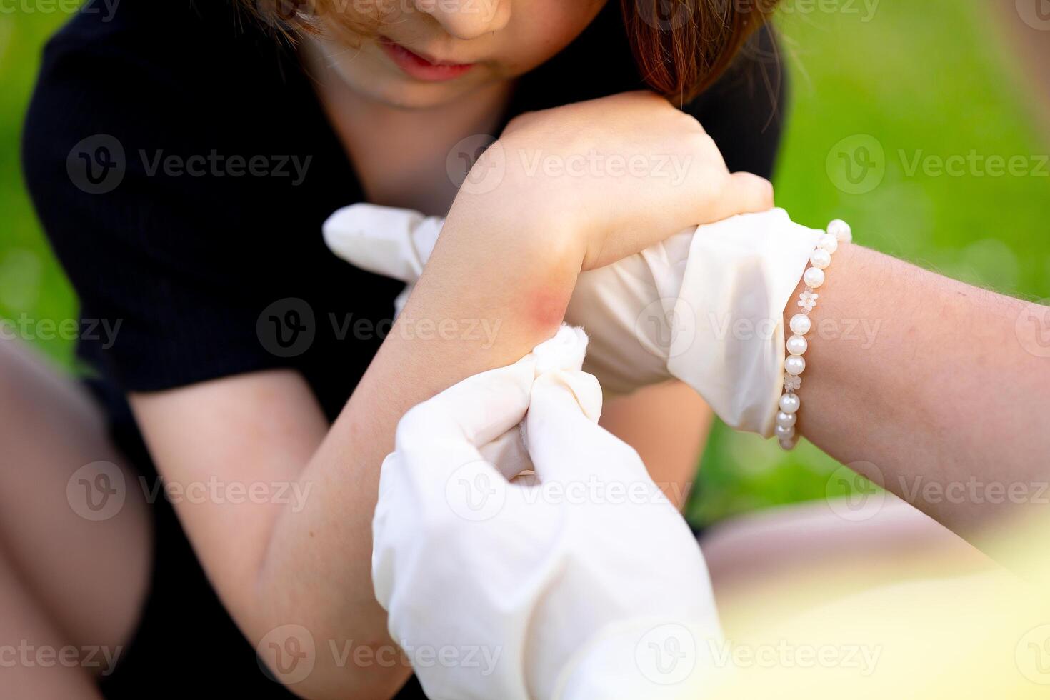 close-up photo of a mother applying cream to her child's hand after an insect, mosquito or bee bite in the summer in the yard