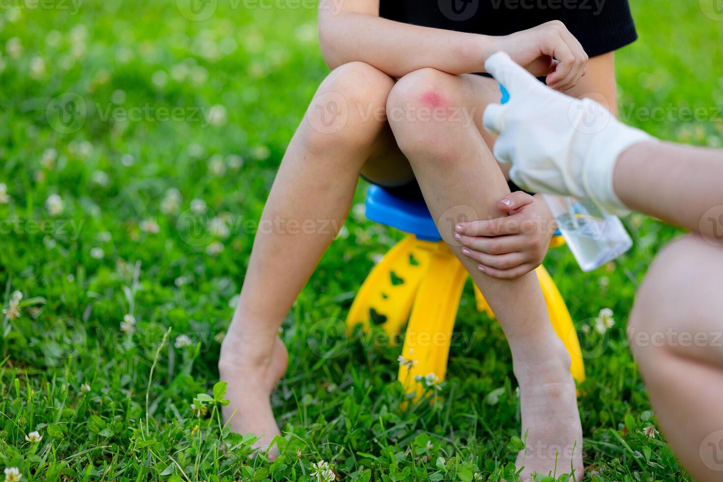 A child injured his knee while playing. Close-up of a wound on a child's knee. The mother examines the child's knee and sprays an antiseptic spray photo