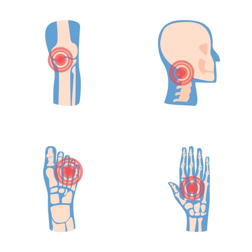 Joint disease icons set cartoon vector. Human joint with red pain ring vector