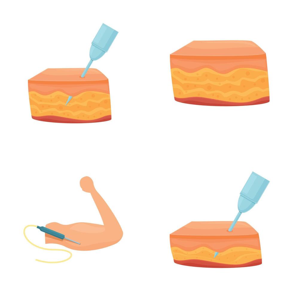 Cryolipolysis icons set cartoon vector. Surgical procedure of cryolipolysis vector