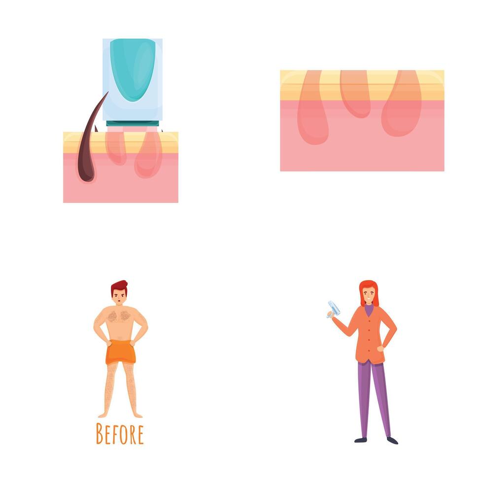 Epilation concept icons set cartoon vector. Hardware hair removal vector