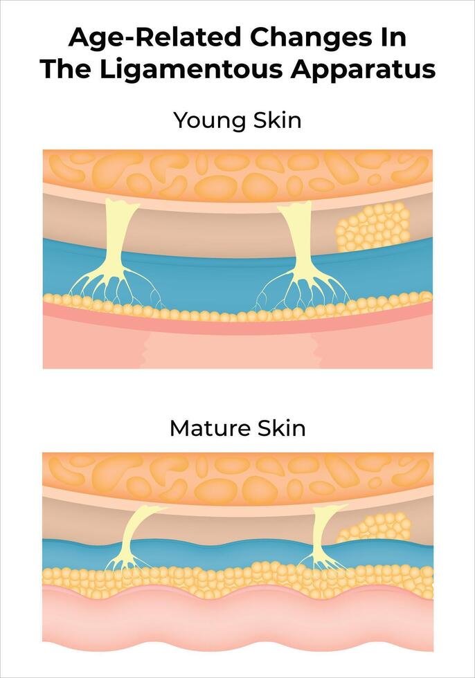Age-Related Changes in The Ligamentous Apparatus Science Design Illustration Diagram vector