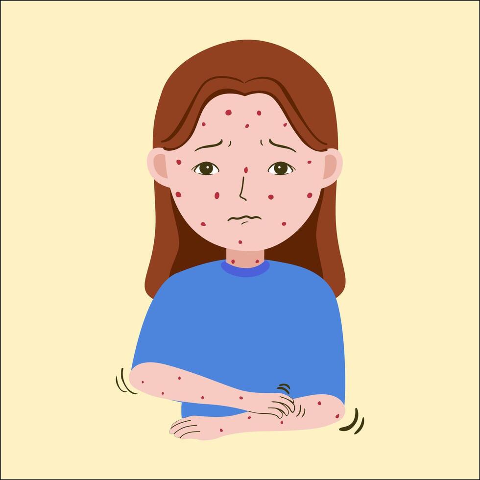 illustration of a woman sick, feeling itchy and scratching her hands vector