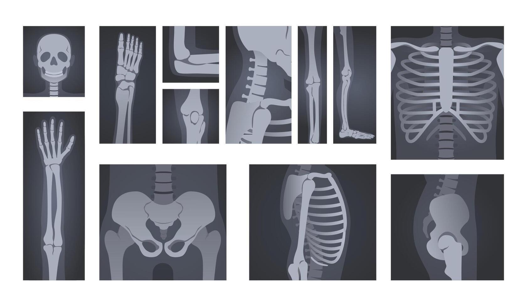 X-ray shots. Human body radiology of head skull, hand bones, spine and rib cage illustration set vector