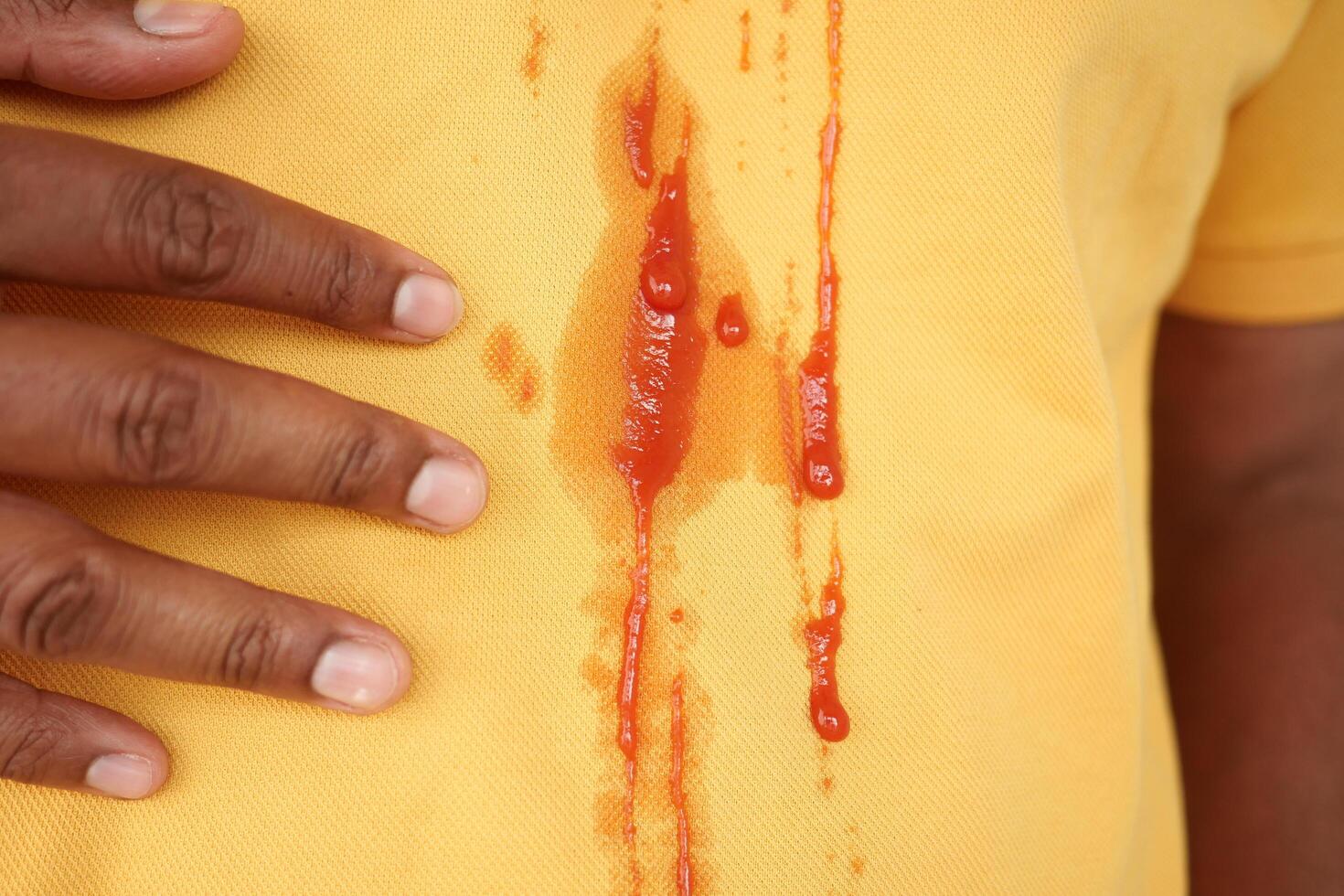 A yellow shirt was stained by spilled ketchup, requiring cleaning to remove the blot photo