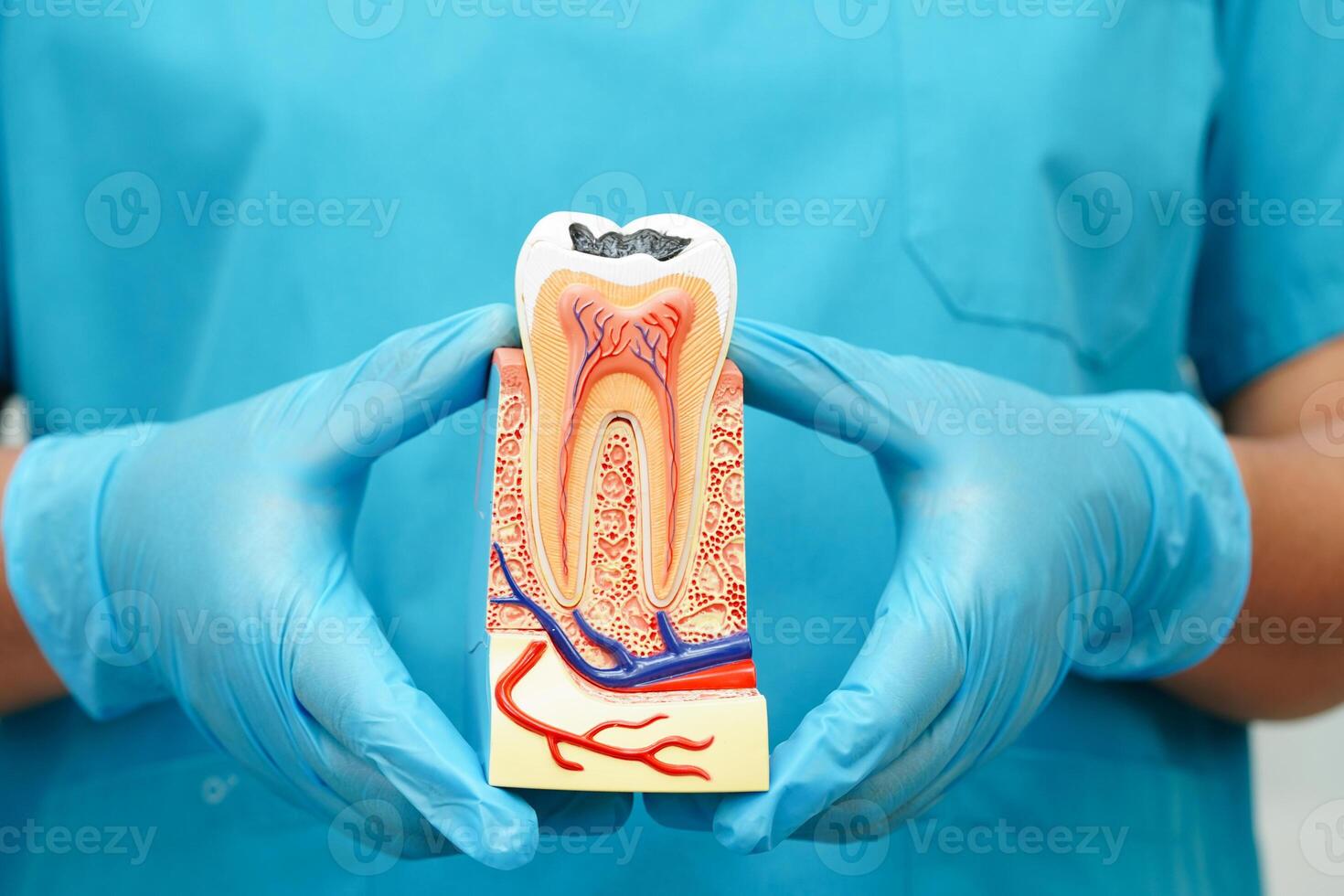 Dentist holding dental implant, artificial tooth roots into jaw, root canal of dental treatment, gum disease, teeth model for dentist. photo