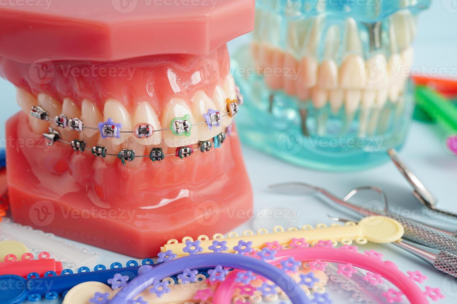 Orthodontic ligatures rings and ties, elastic rubber bands on orthodontic braces, model for dentist studying about dentistry. photo