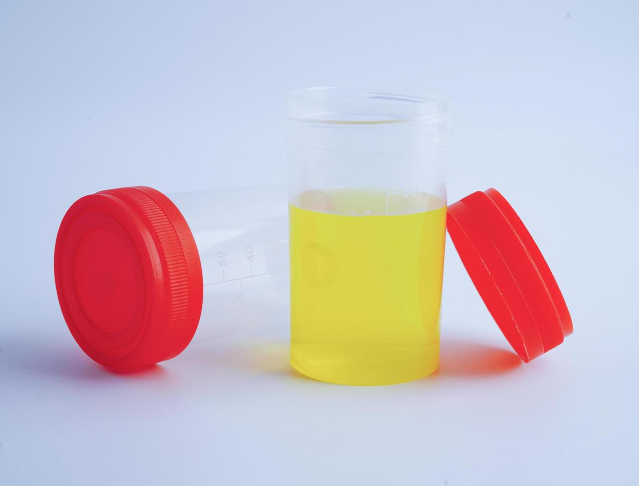 Urinalysis, urine cup for check health examination in laboratory. photo