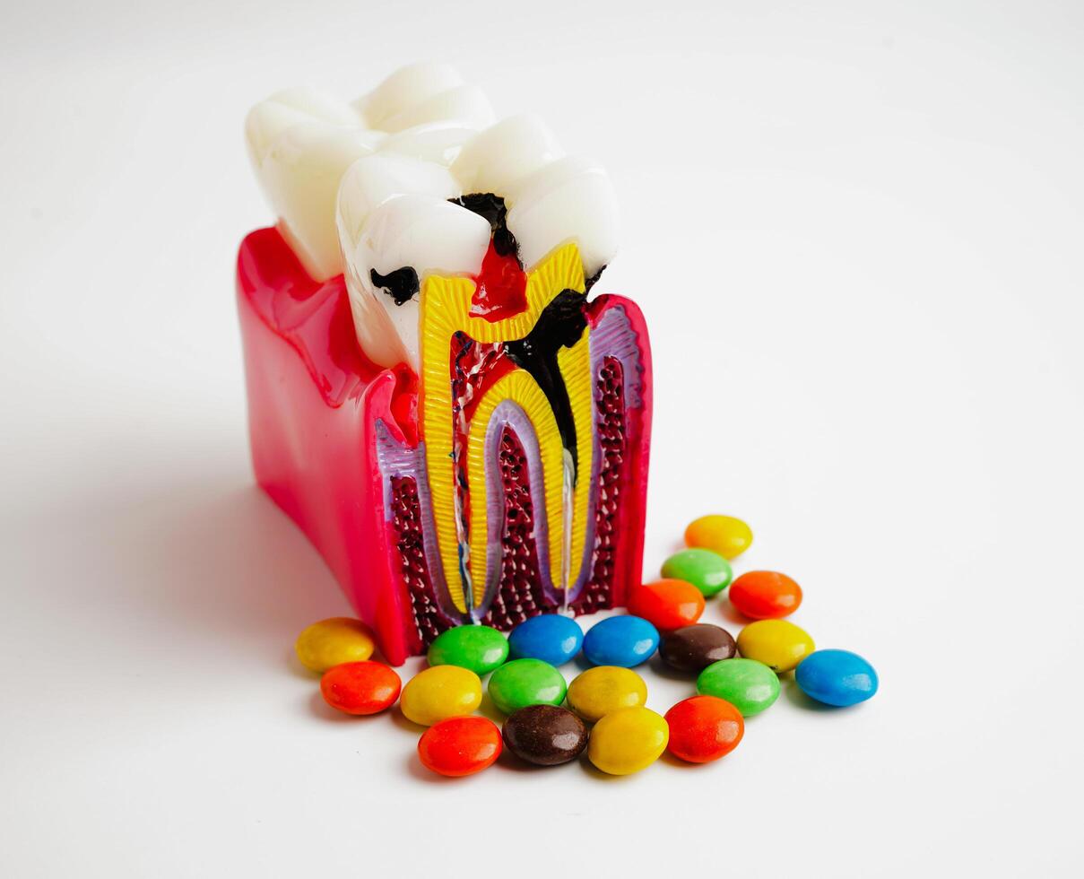 Tooth decay with sweet sugar candy, bad food for dental health care. photo