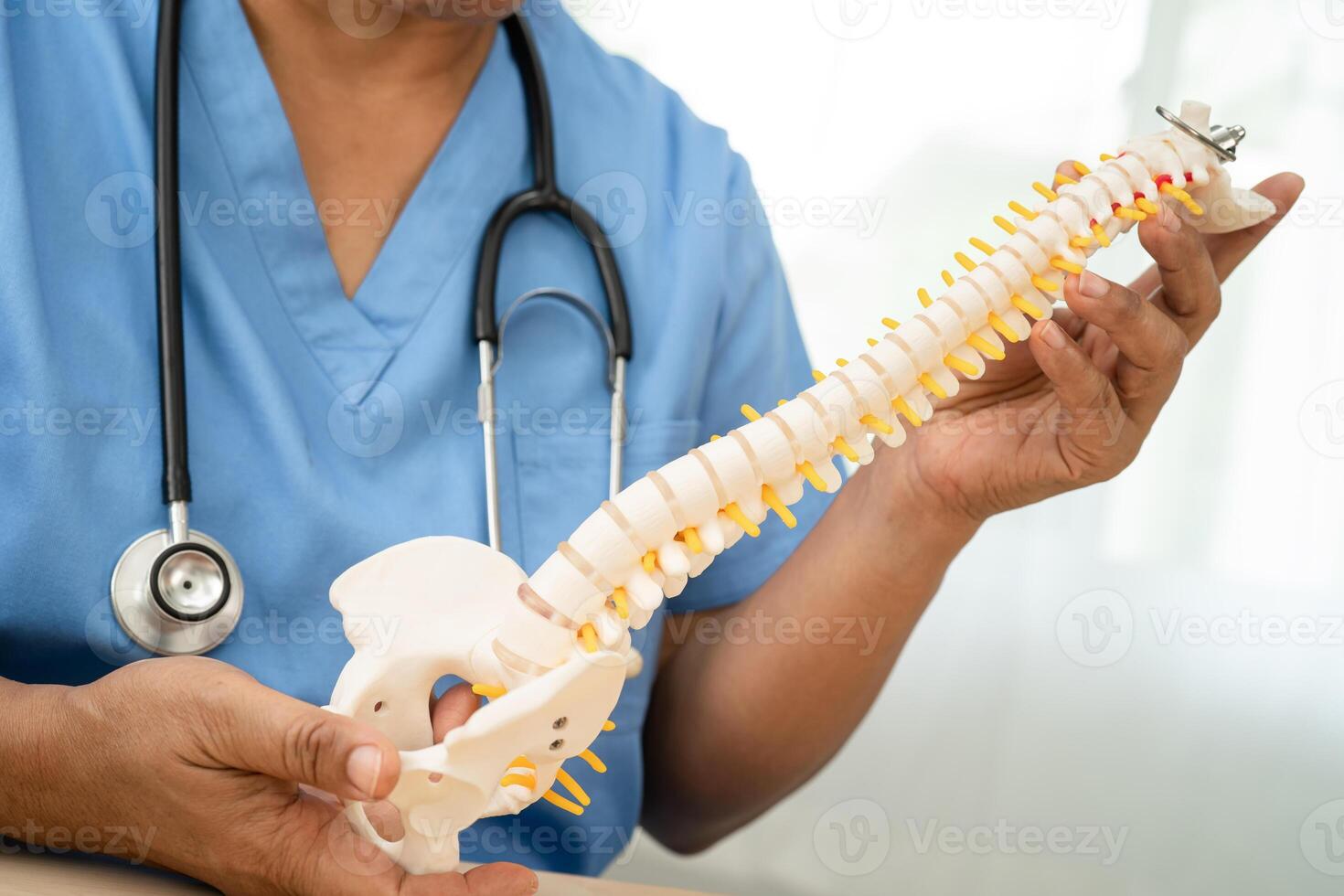 Asian doctor holding spinal nerve and bone model, Lumbar spine displaced herniated disc fragment for treatment medical in the orthopedic department. photo