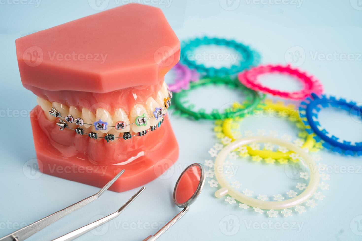 Orthodontic ligatures rings and ties, elastic rubber bands on orthodontic braces, model for dentist studying about dentistry. photo