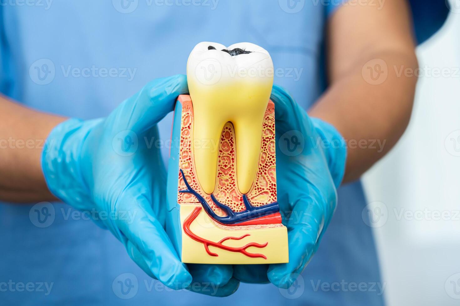 Asian dentist holding dental implant, artificial tooth roots into jaw, root canal of dental treatment, gum disease, teeth model for dentist. photo