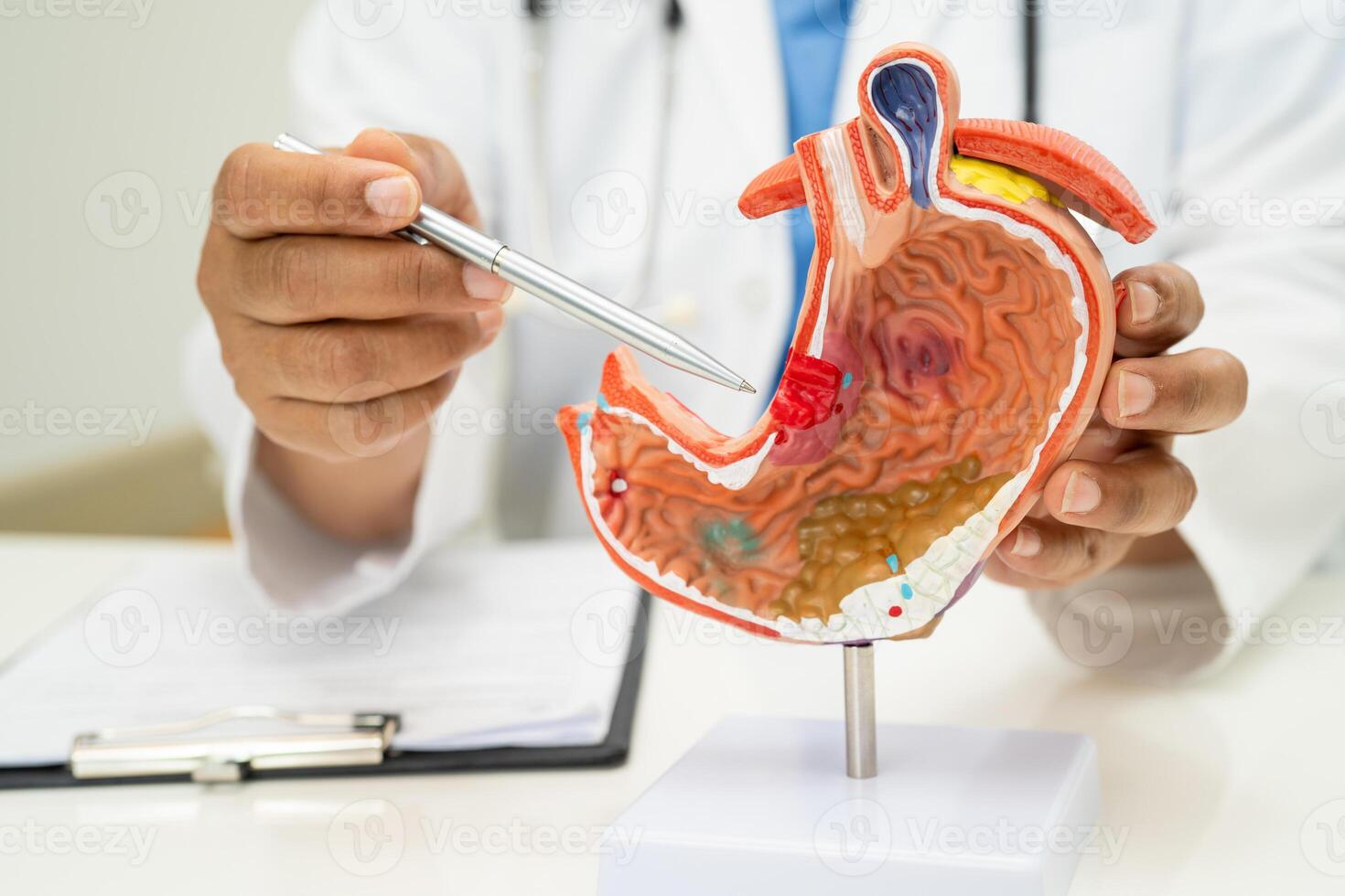 Stomach disease, doctor with human anatomy model for study diagnosis and treatment in hospital. photo