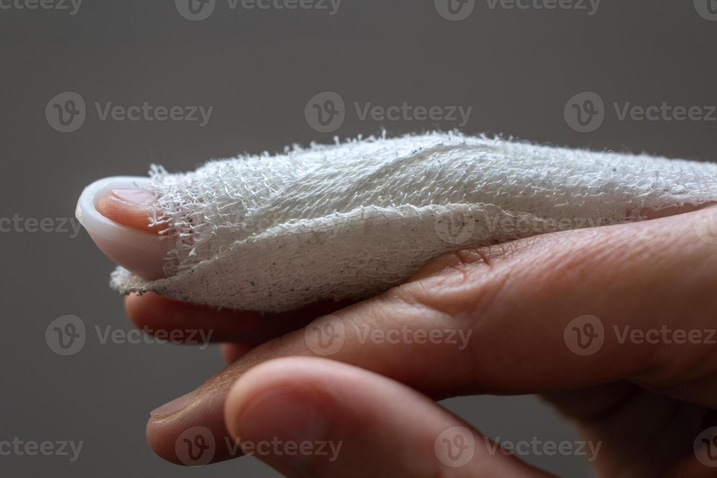 Mallet finger, stack splint on the middle finger with bandage to immobilize the last phalanx following joint trauma photo