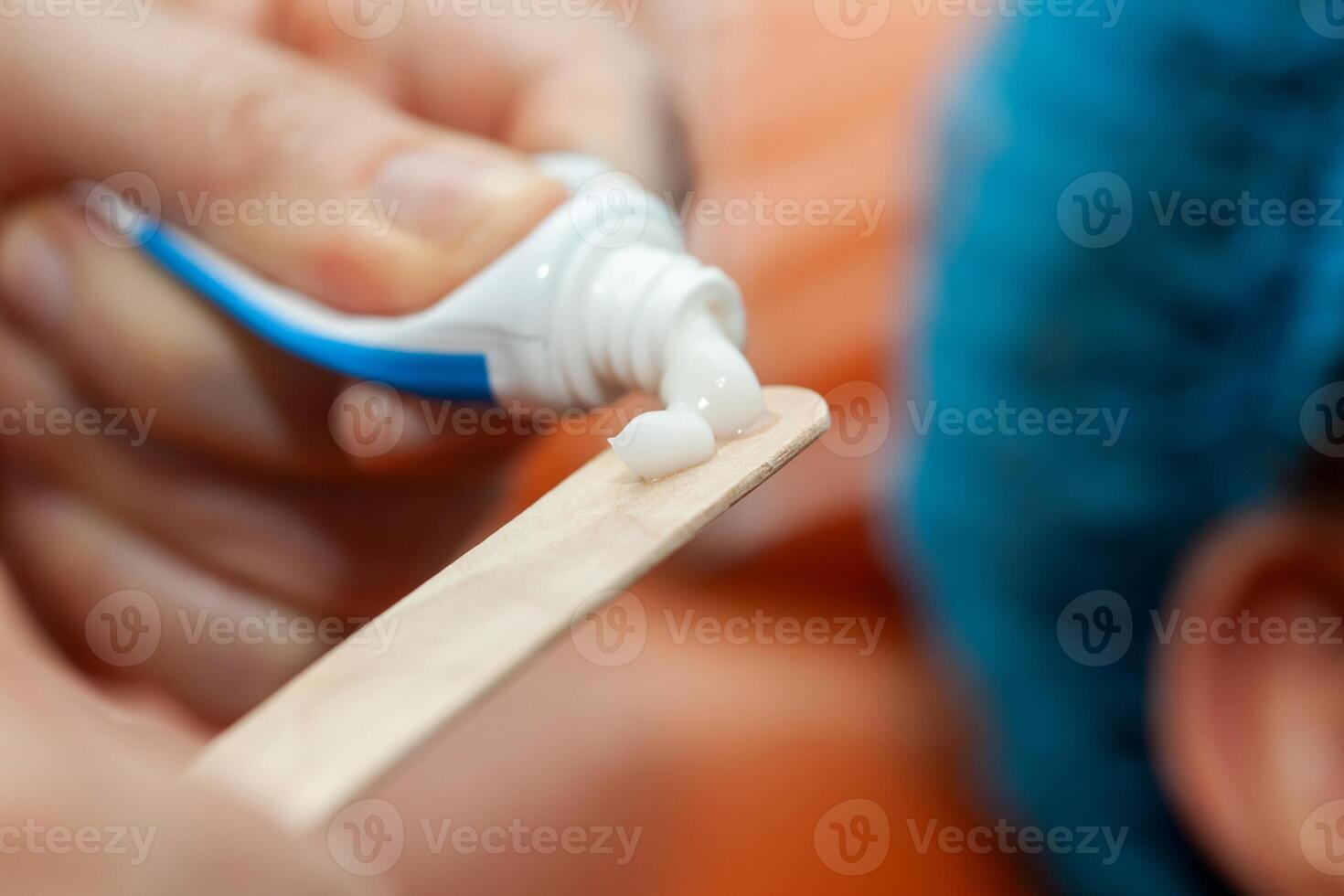 Application of topical anesthesia cream prior to a dermatological procedure. photo