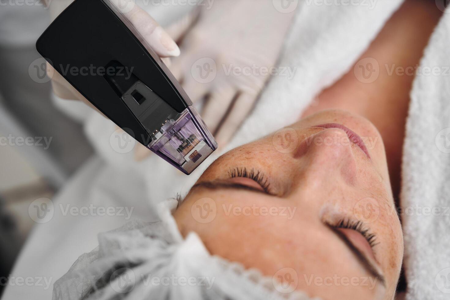 A woman receives Rf-lifting in a beauty salon. photo