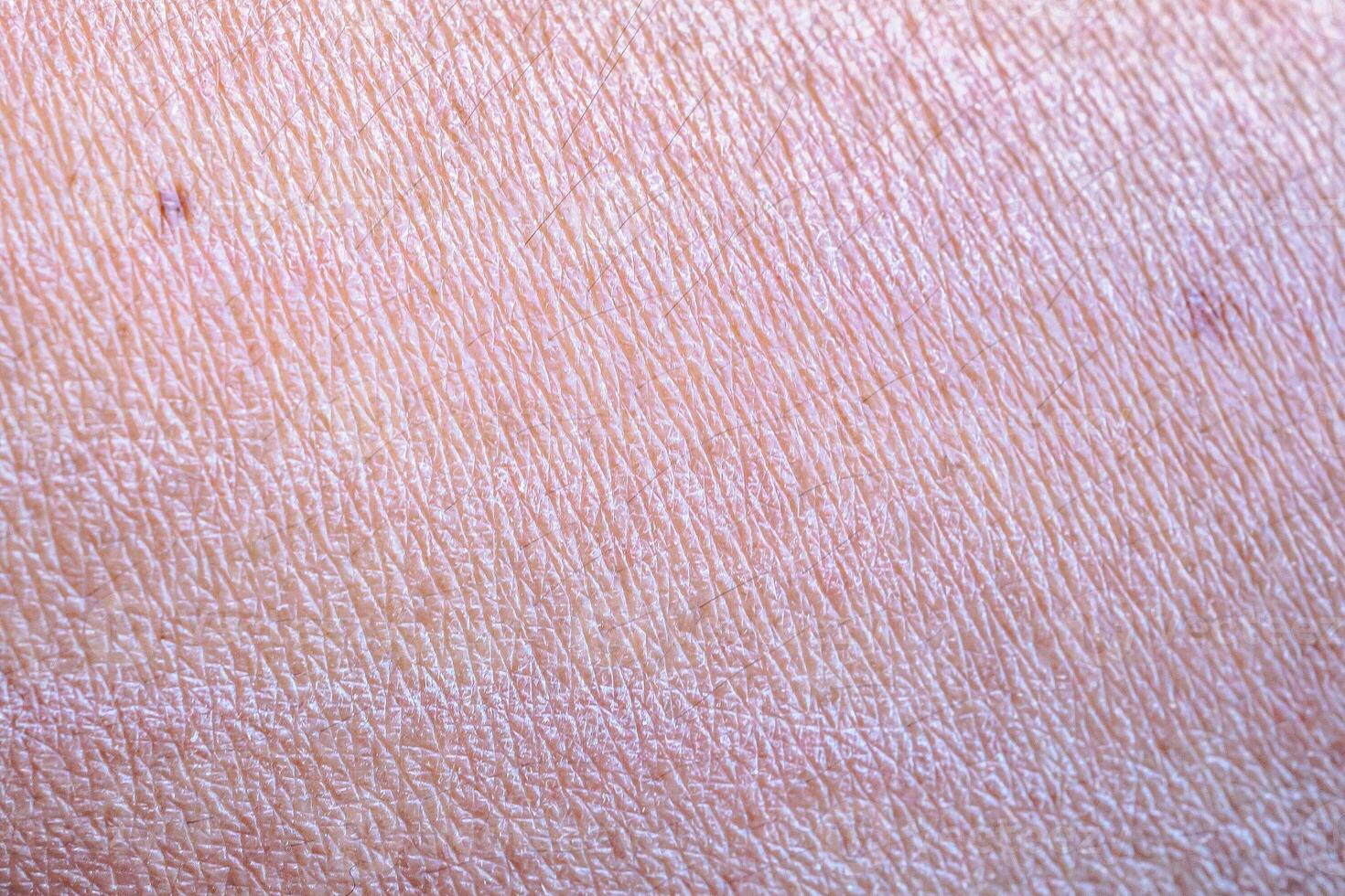 dry and dehydrated human skin texture background photo
