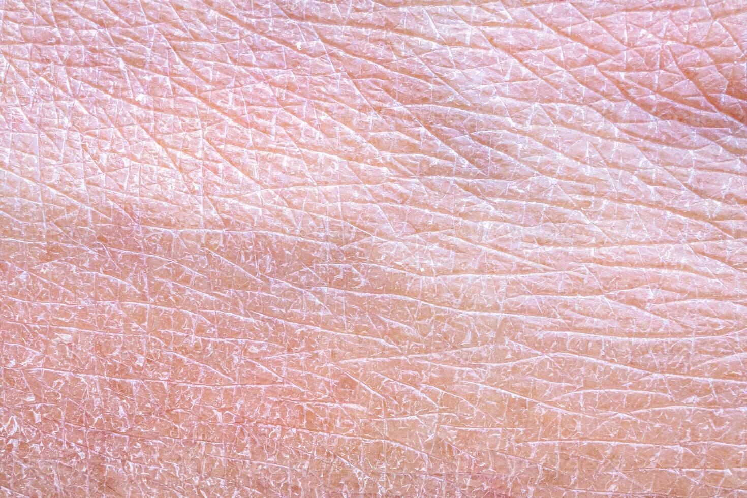 dry and dehydrated human skin texture background photo