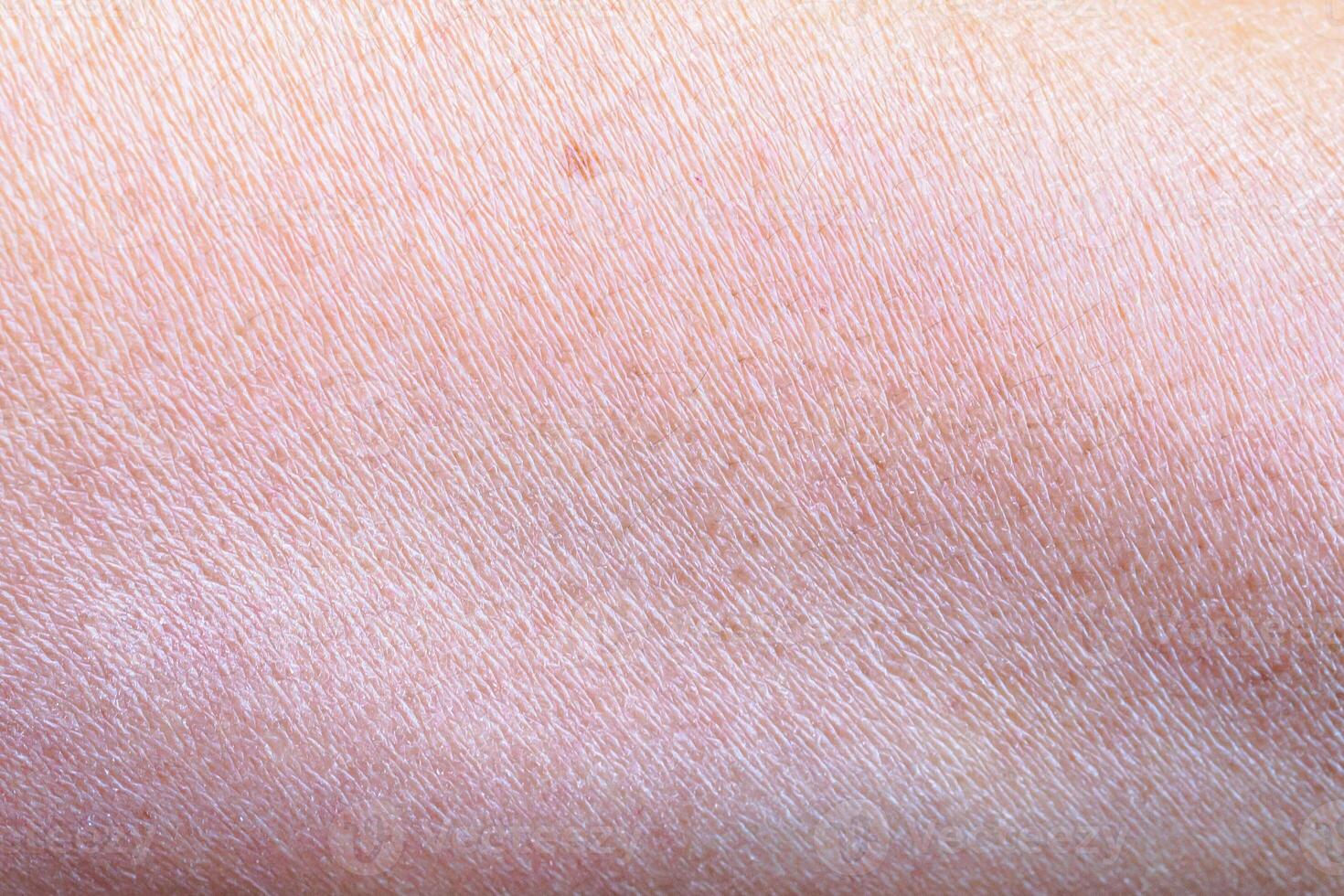 dry and dehydrated human skin texture background photo