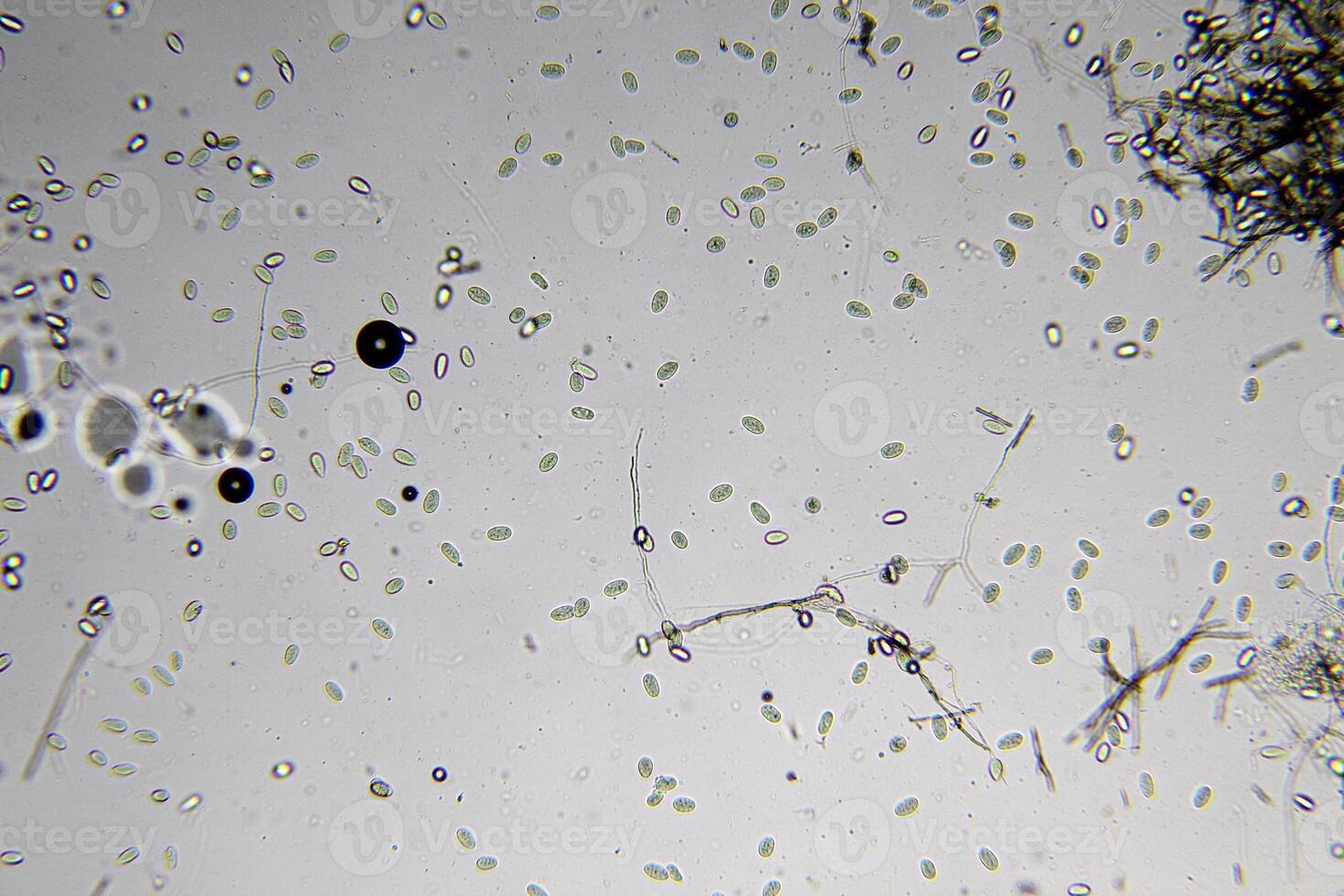 Penicillium, ascomycetous fungi are of major importance in the natural environment as well as food and drug production. photo