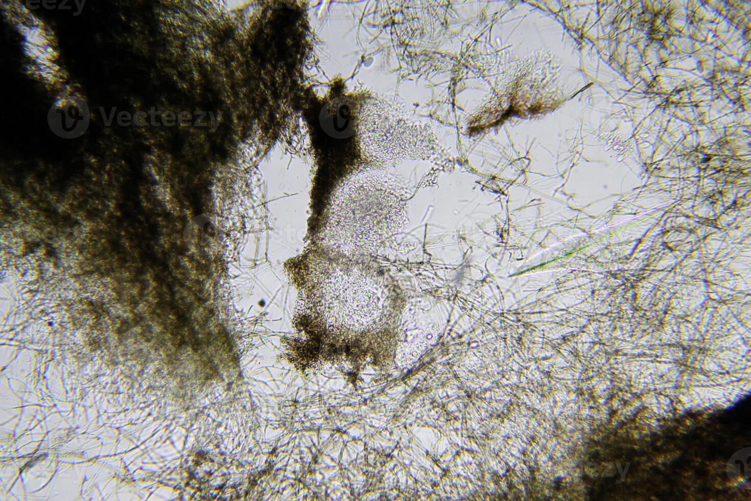 Penicillium, ascomycetous fungi are of major importance in the natural environment as well as food and drug production. photo