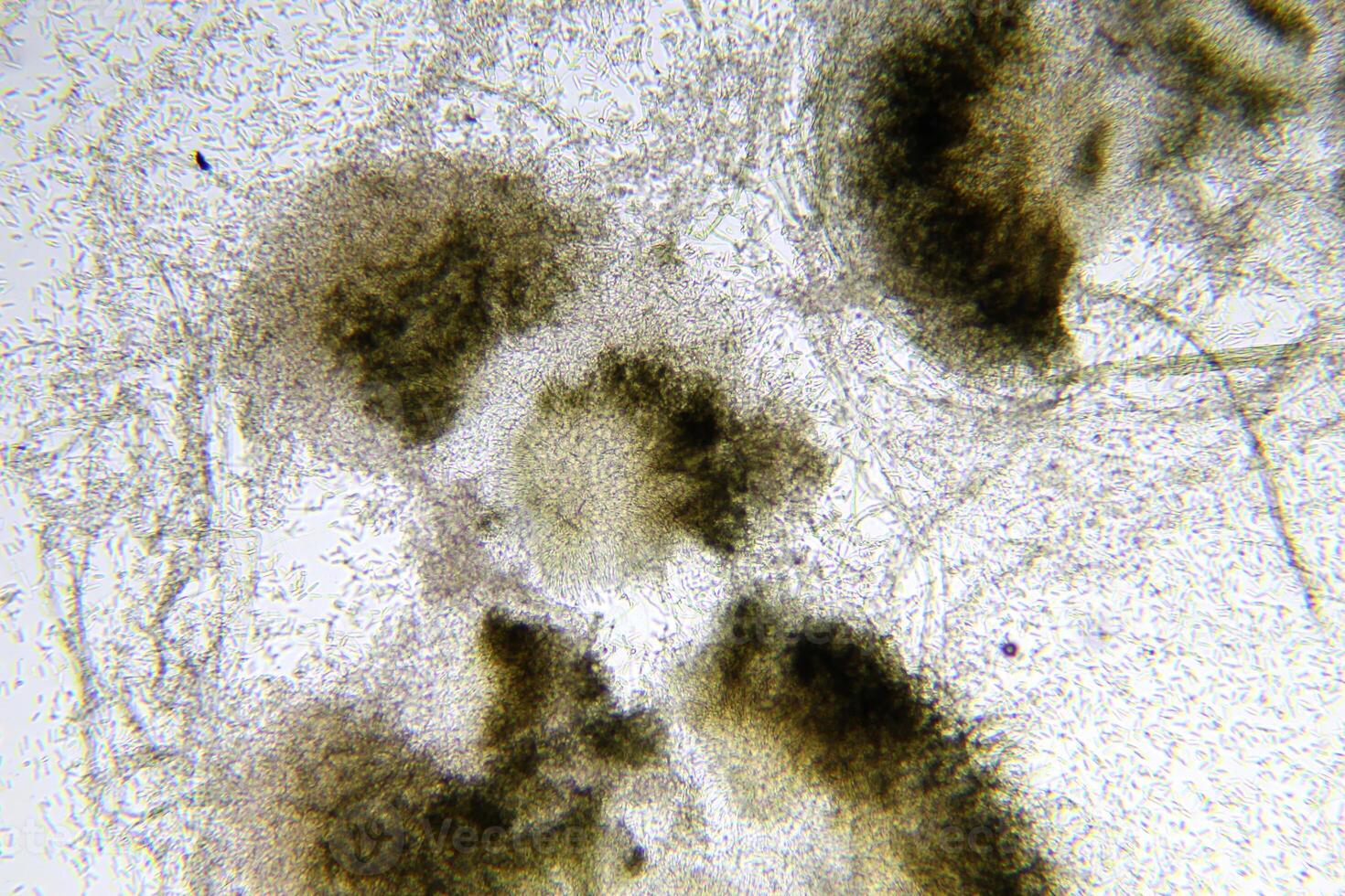 Penicillium, ascomycetous fungi are of major importance in the natural environment as well as food and drug production. photo