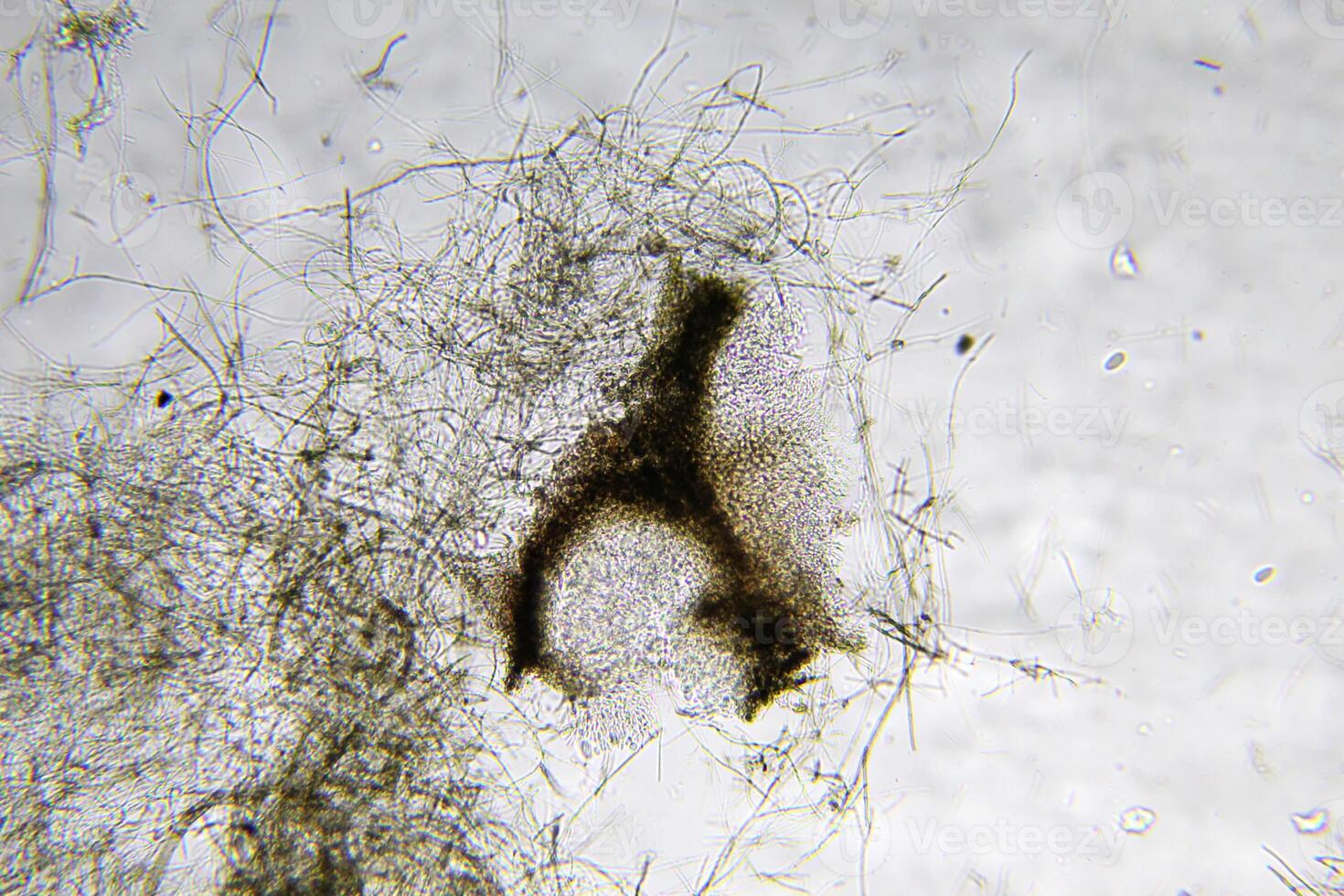Penicillium, ascomycetous fungi are of major importance in the natural environment as well as food and drug production. photo