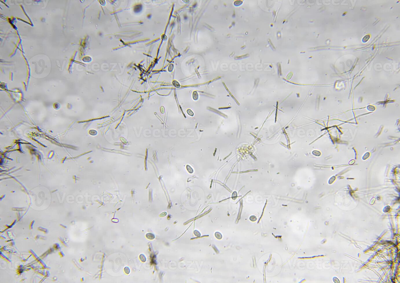 Penicillium, ascomycetous fungi are of major importance in the natural environment as well as food and drug production. photo