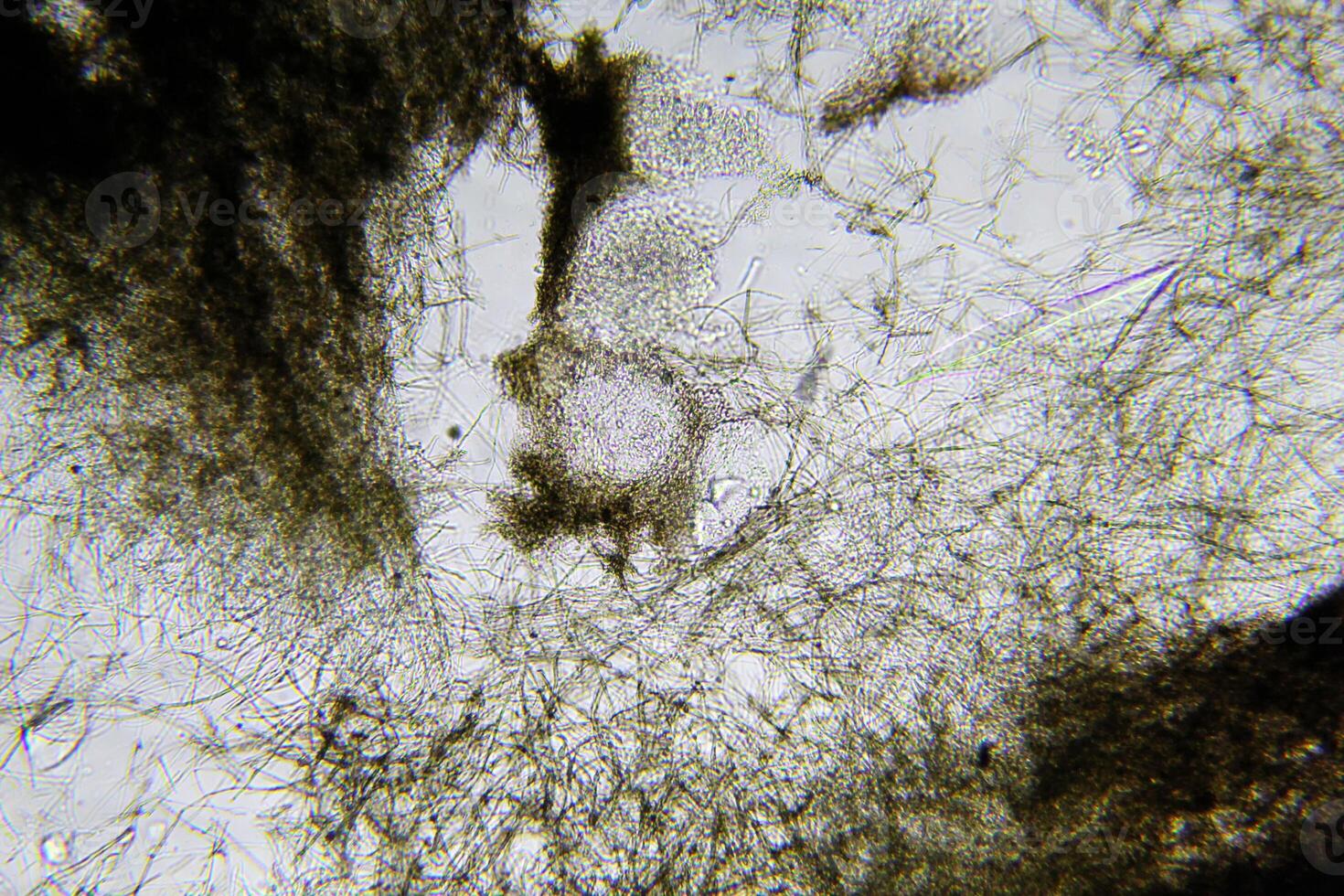 Penicillium, ascomycetous fungi are of major importance in the natural environment as well as food and drug production. photo